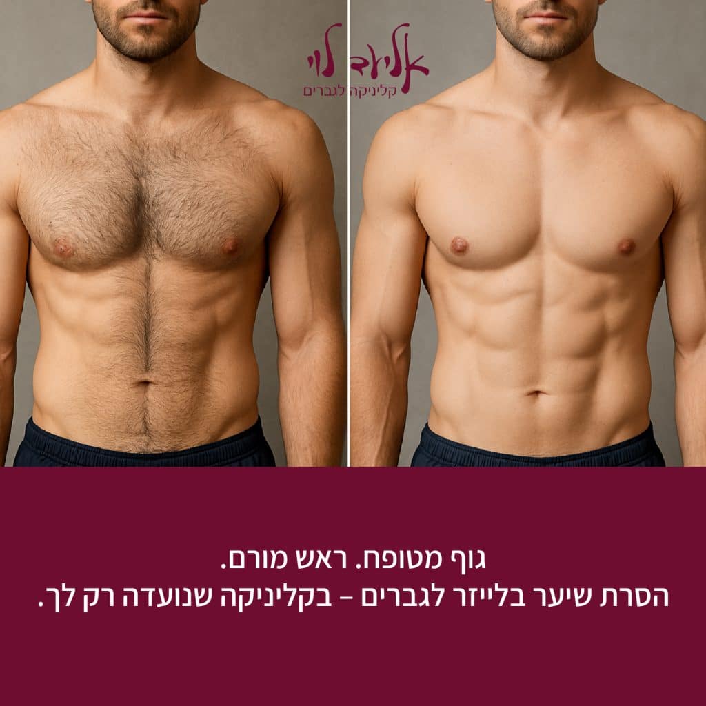 לייזר לגברים אחרי גירושין 